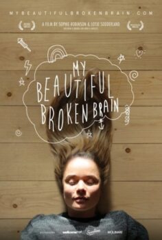 My Beautiful Broken Brain izle